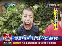 世界最大嘴巴! 口9.34公分破 可塞球.果 少年大嘴打破金氏